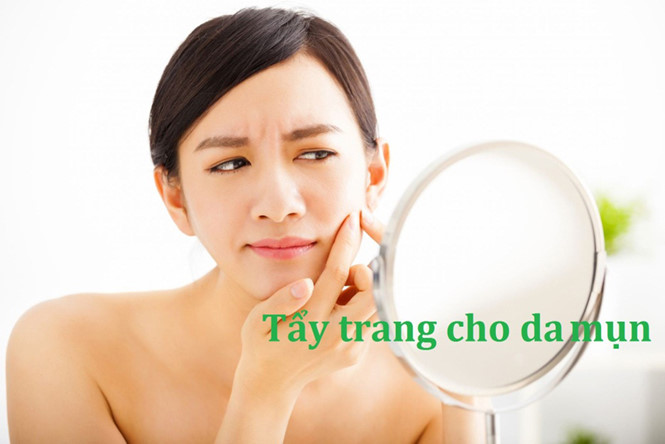 Sản phẩm tẩy trang nào phù hợp với làn da nhờn mụn?